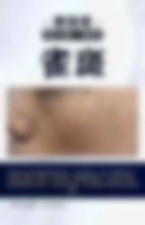 三、临床实战与真实实例